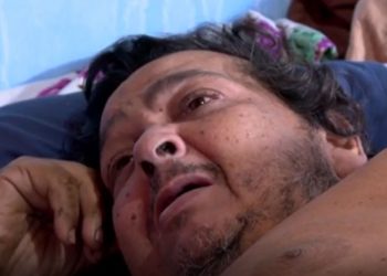 Mecânico de mais de 200 kg é internado em hospital após passar 20 dias acamado em oficina de Cuiabá